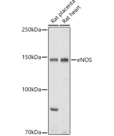 eNOS Rabbit Polyclonal Antibody