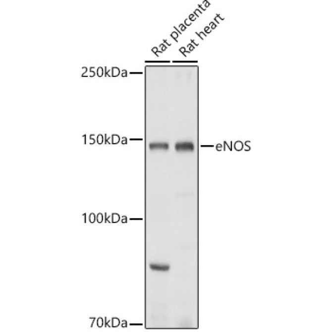 eNOS Rabbit Polyclonal Antibody