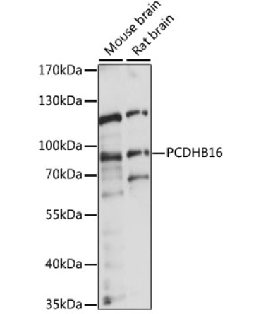 PCDHB16 Rabbit Polyclonal Antibody