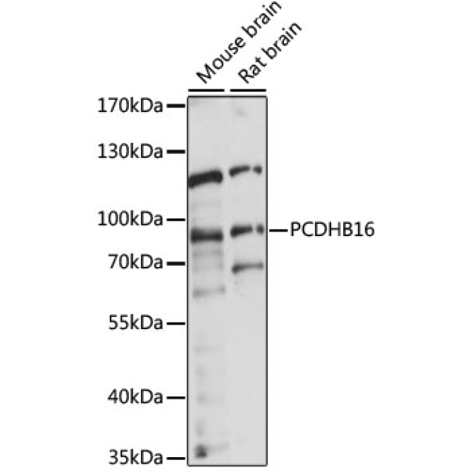 PCDHB16 Rabbit Polyclonal Antibody