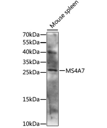 MS4A7 Rabbit Polyclonal Antibody
