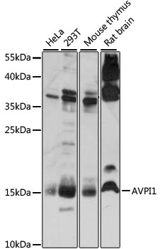 AVPI1 Rabbit Polyclonal Antibody