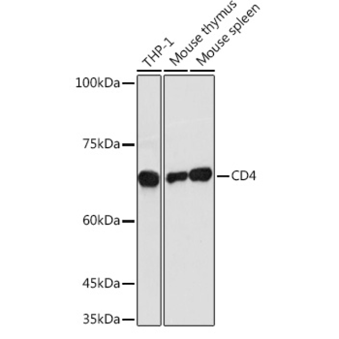 CD4 Rabbit Polyclonal Antibody