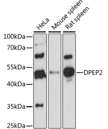 DPEP2 Rabbit Polyclonal Antibody