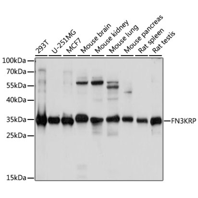 FN3KRP Rabbit Polyclonal Antibody