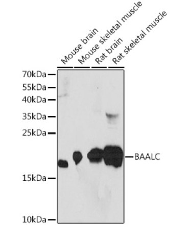 BAALC Rabbit Polyclonal Antibody