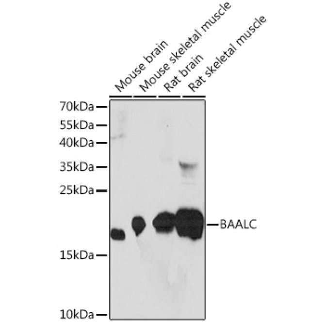 BAALC Rabbit Polyclonal Antibody