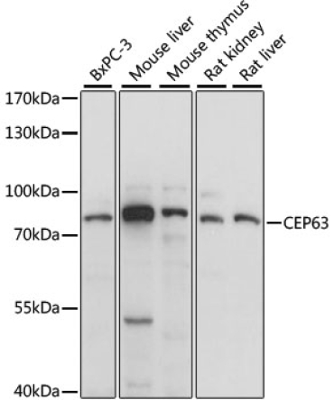 CEP63 Rabbit Polyclonal Antibody