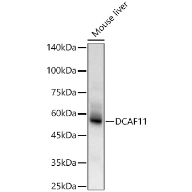 DCAF11 Rabbit Polyclonal Antibody