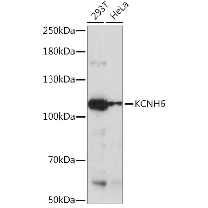 KCNH6 Rabbit Polyclonal Antibody