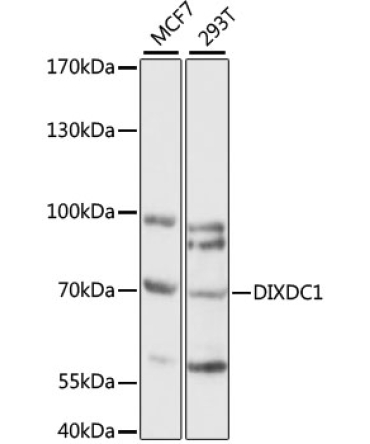 DIXDC1 Rabbit Polyclonal Antibody