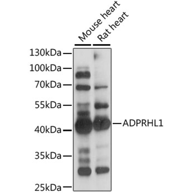 ADPRHL1 Rabbit Polyclonal Antibody