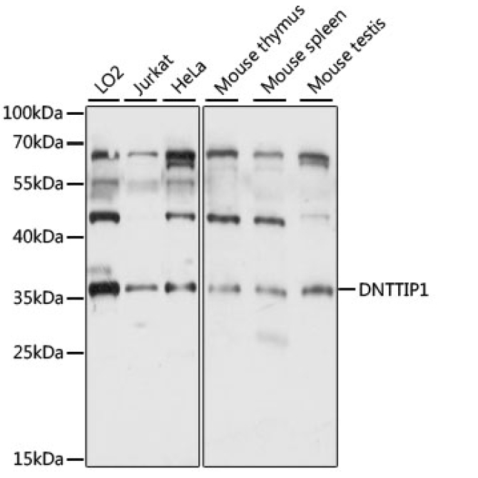 DNTTIP1 Rabbit Polyclonal Antibody
