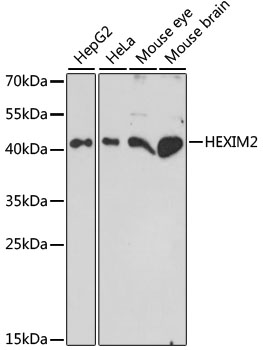 HEXIM2 Rabbit Polyclonal Antibody