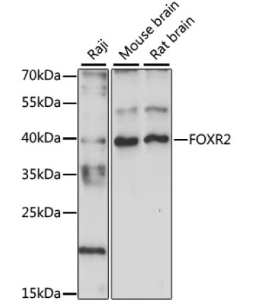 FOXR2 Rabbit Polyclonal Antibody