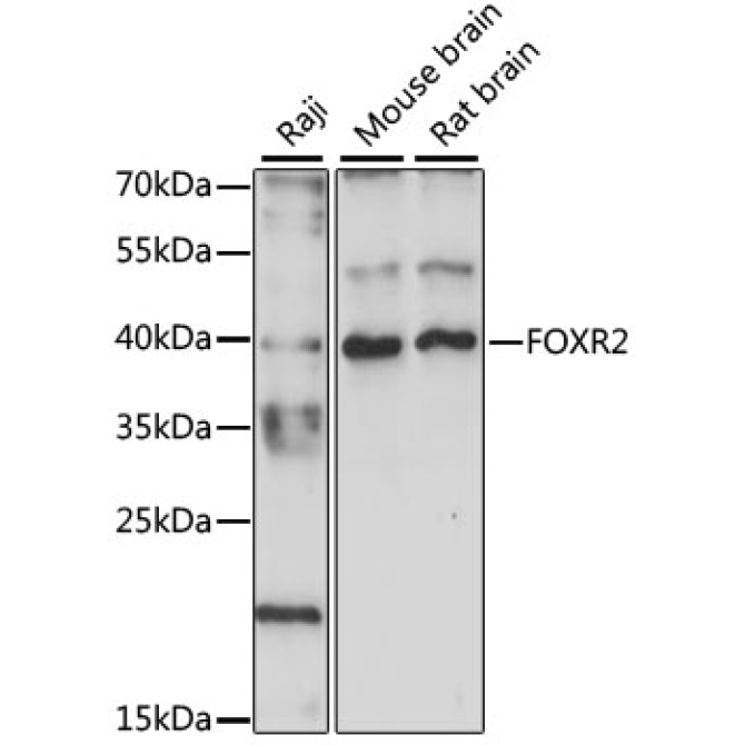 FOXR2 Rabbit Polyclonal Antibody