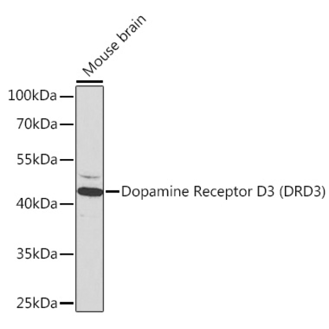 Dopamine Receptor D3 (DRD3) Rabbit Polyclonal Antibody