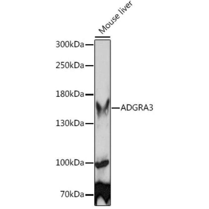 ADGRA3 Rabbit Polyclonal Antibody