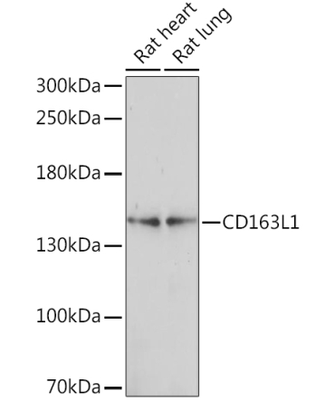 CD163L1 Rabbit Polyclonal Antibody