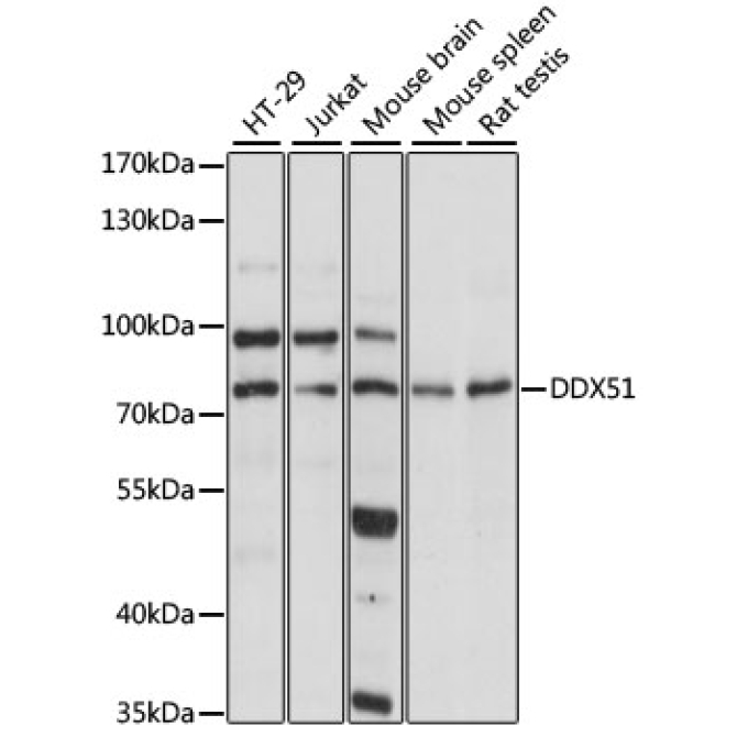 DDX51 Rabbit Polyclonal Antibody