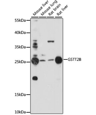 GSTT2B Rabbit Polyclonal Antibody