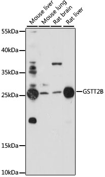GSTT2B Rabbit Polyclonal Antibody