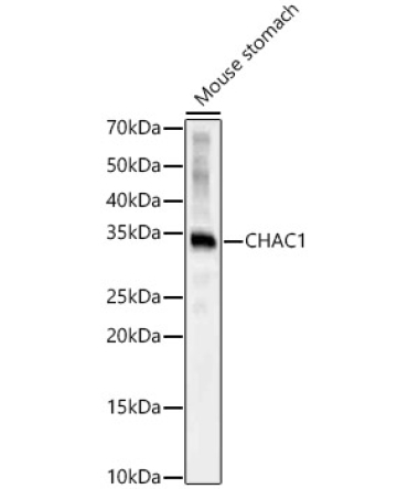 CHAC1 Rabbit Polyclonal Antibody