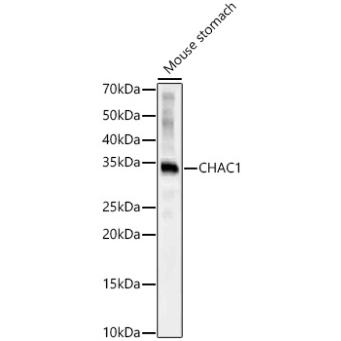 CHAC1 Rabbit Polyclonal Antibody
