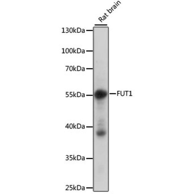FUT1 Rabbit Polyclonal Antibody