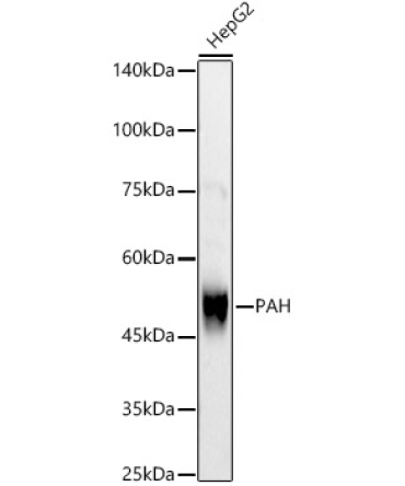 PAH Rabbit Polyclonal Antibody