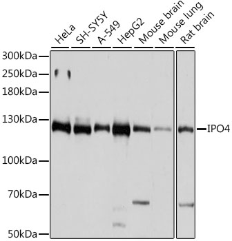 IPO4 Rabbit Polyclonal Antibody