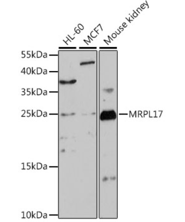 MRPL17 Rabbit Polyclonal Antibody