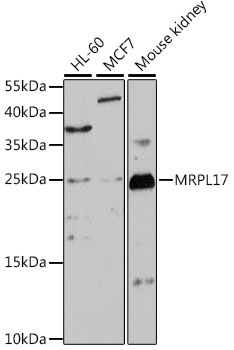 MRPL17 Rabbit Polyclonal Antibody