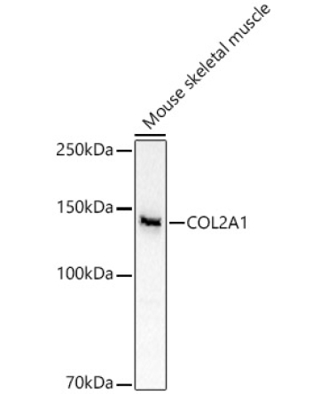 COL2A1 Rabbit Polyclonal Antibody
