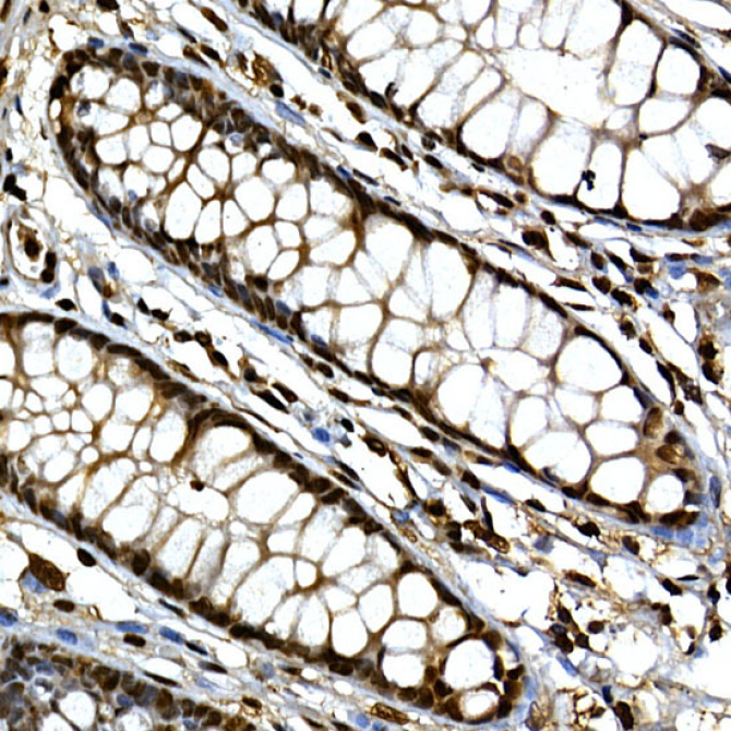 GLI3 Rabbit Polyclonal Antibody