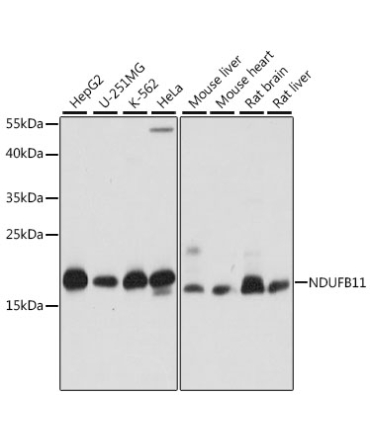 NDUFB11 Rabbit Polyclonal Antibody