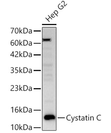 Cystatin C Rabbit Polyclonal Antibody