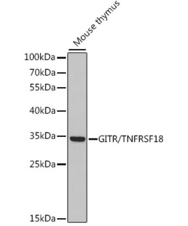 GITR/TNFRSF18 Rabbit Polyclonal Antibody
