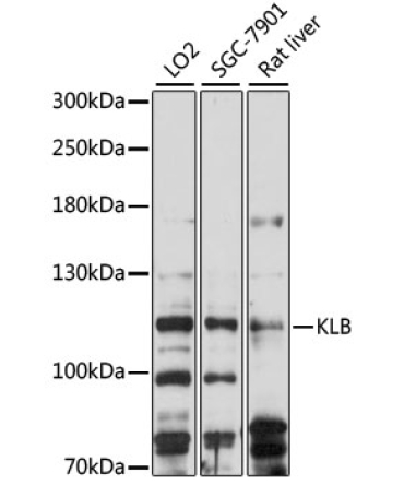 KLB Rabbit Polyclonal Antibody
