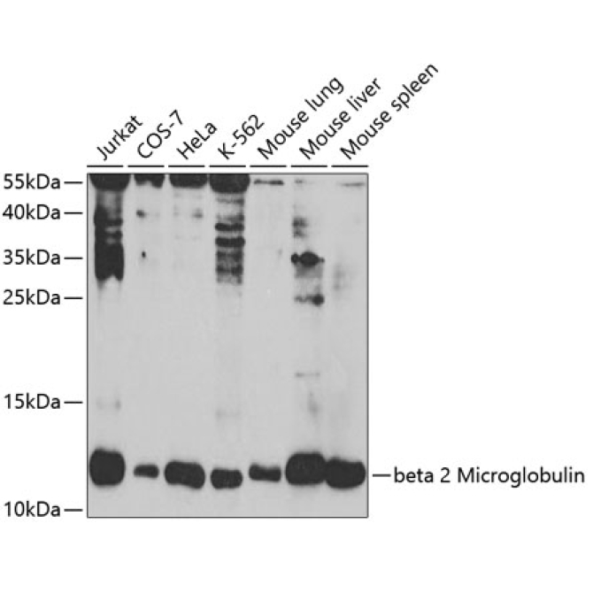 beta 2 Microglobulin Rabbit Polyclonal Antibody