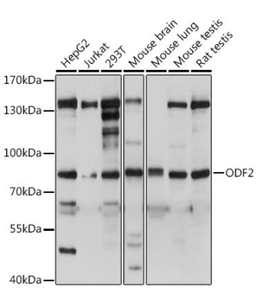 ODF2 Rabbit Polyclonal Antibody