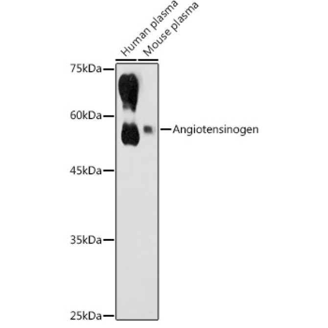 Angiotensinogen Rabbit Polyclonal Antibody