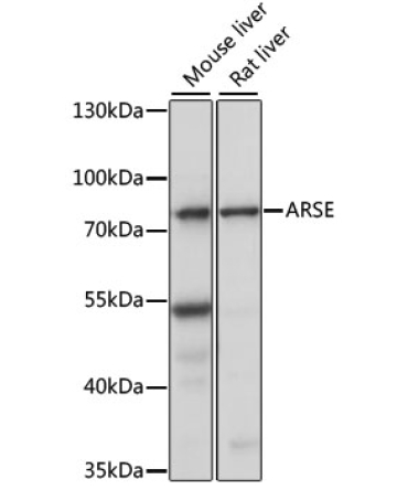 ARSE Rabbit Polyclonal Antibody