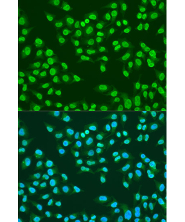 ATM Rabbit Polyclonal Antibody