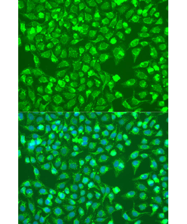 BMP6 Rabbit Polyclonal Antibody