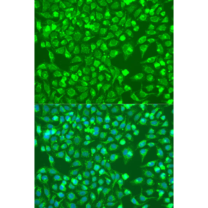 BMP6 Rabbit Polyclonal Antibody
