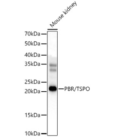 PBR/TSPO Rabbit Polyclonal Antibody