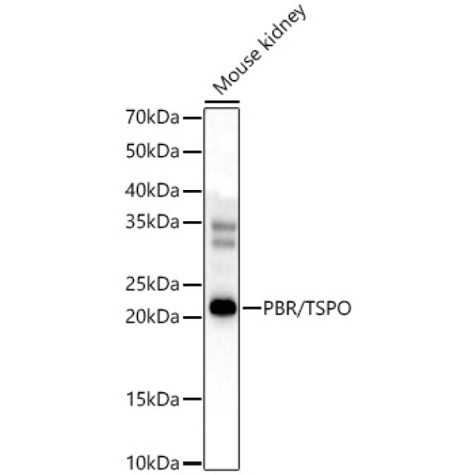 PBR/TSPO Rabbit Polyclonal Antibody
