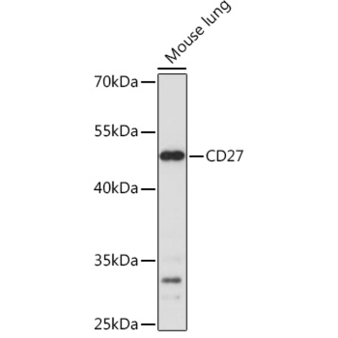 CD27 Rabbit Polyclonal Antibody