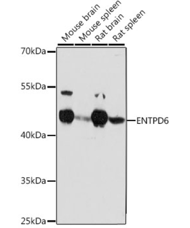 ENTPD6 Rabbit Polyclonal Antibody